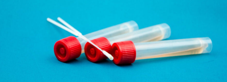 Casoria: confermati dal Sindaco altri 8 casi dopo i 7 della mattinata