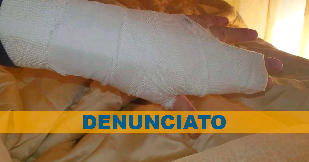 Acerra, l’appello di Mario sparato in una mano per un diverbio stradale: Denunciate