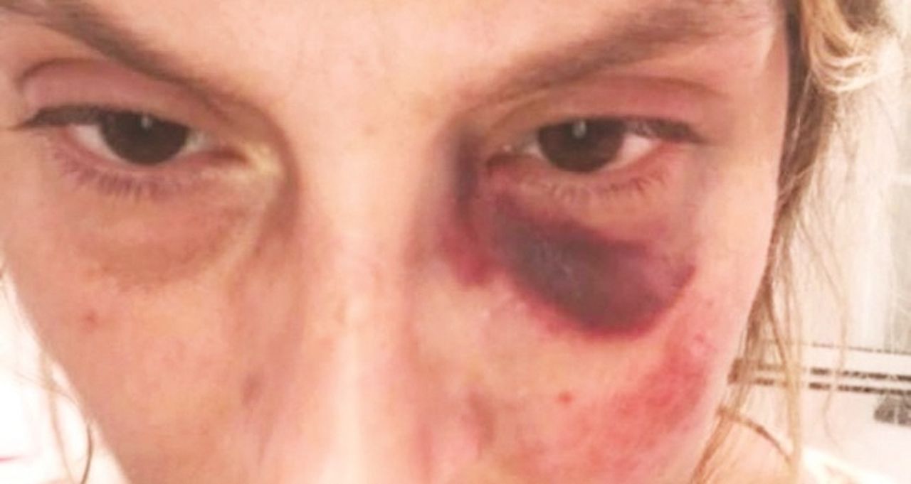 Donna aggredita e picchiata in vacanza, arrestati 4 napoletani