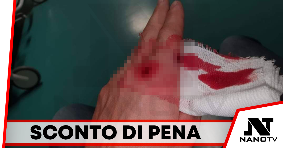 Acerra: sparato ad una mano per futili motivi, ridotta la pena all’aggressore. Borrelli e Simioli: vogliamo condanne certe
