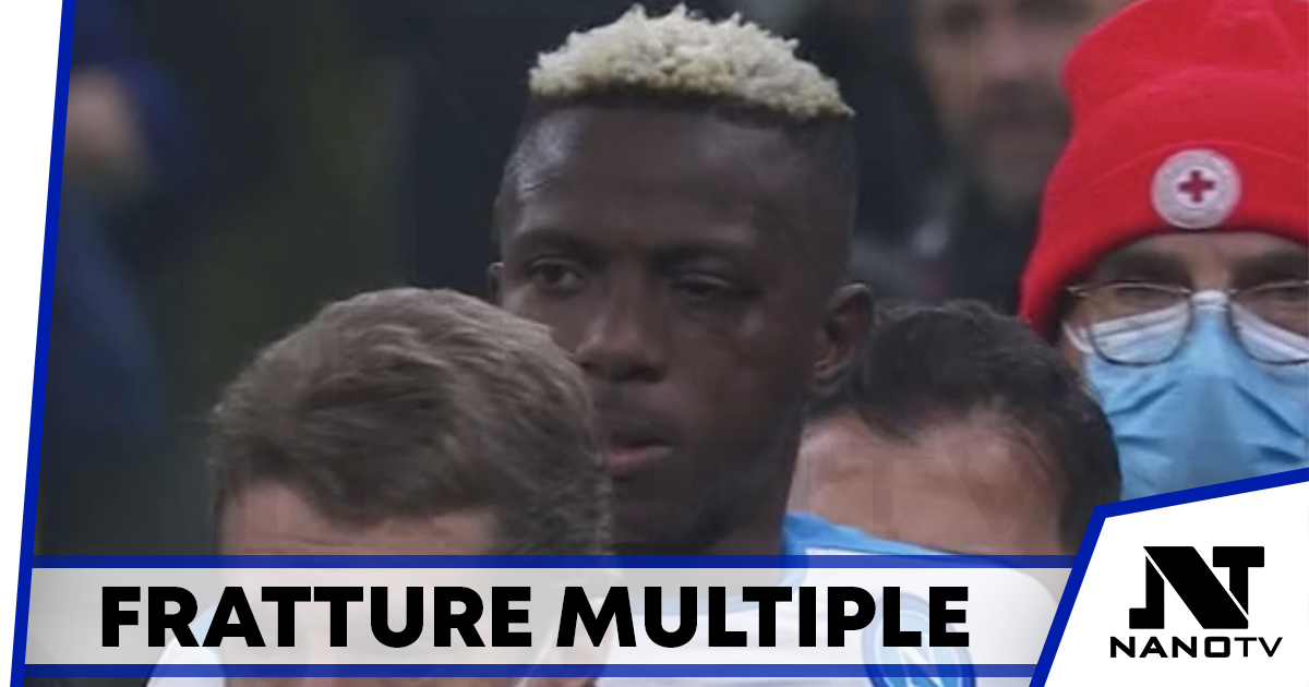 Osimhen che guaio! Fratture multiple allo zigomo, stop lungo