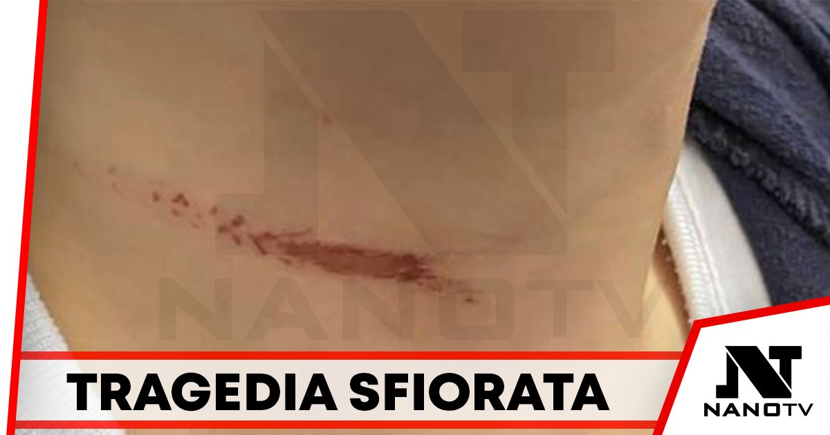 Pomigliano: bambino rischia di restare impiccato per un filo di ferro su uno scivolo