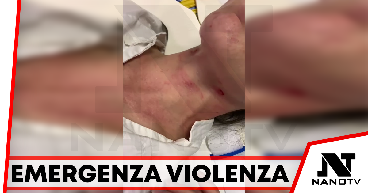 Napoli, colpisce un piede per sbaglio: si ritrova con una costola rotta e strangolata