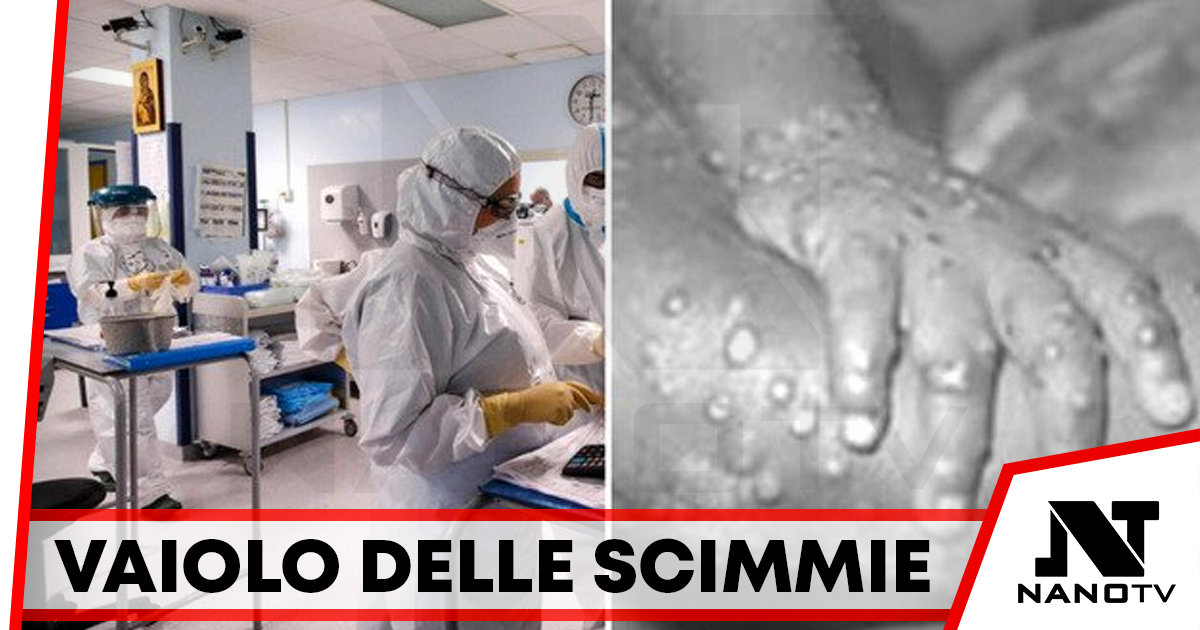 Primo caso di “Vaiolo delle scimmie” in Italia