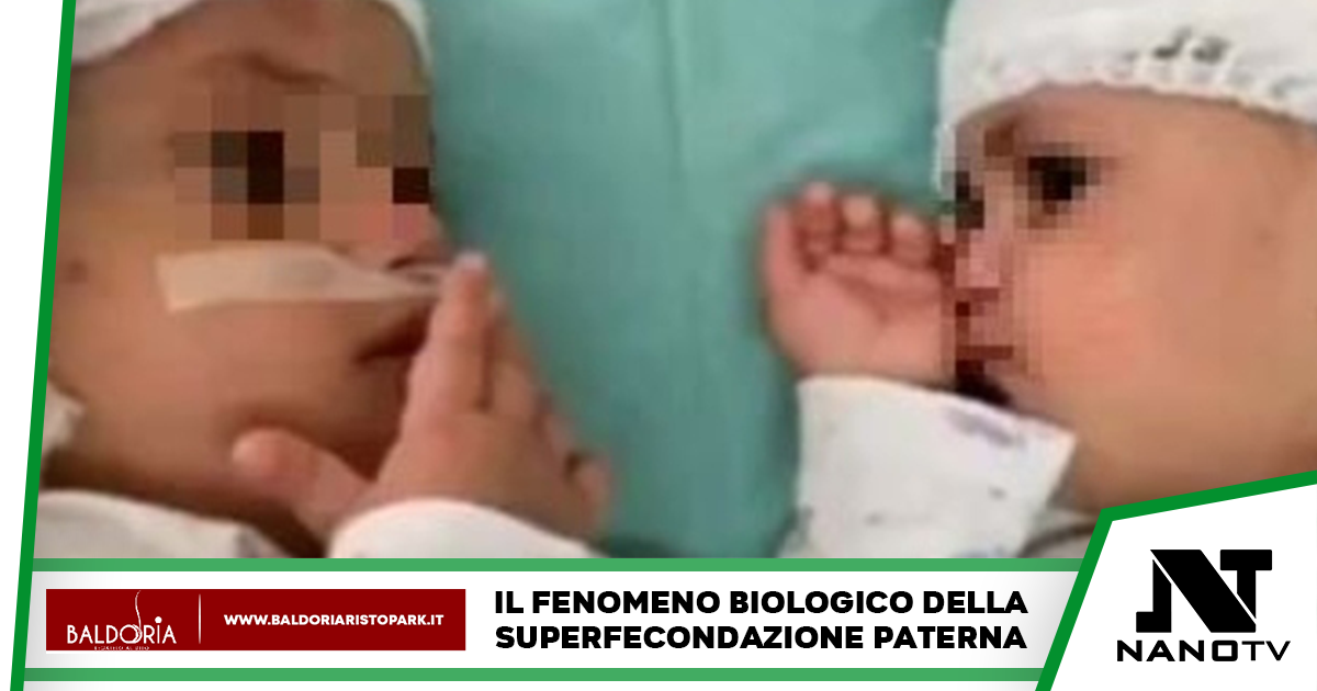 Partorisce due gemelli appartenenti a due padri diversi