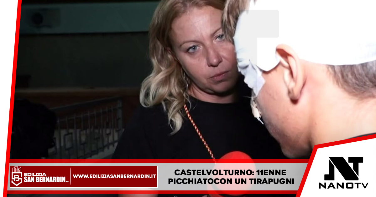 Castel Volturno: 11enne picchiato con un tirapugni