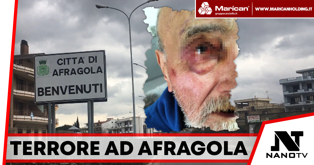 Afragola sotto shock: Anziano brutalmente aggredito dalla baby gang, la figlia lancia un grido di allarme