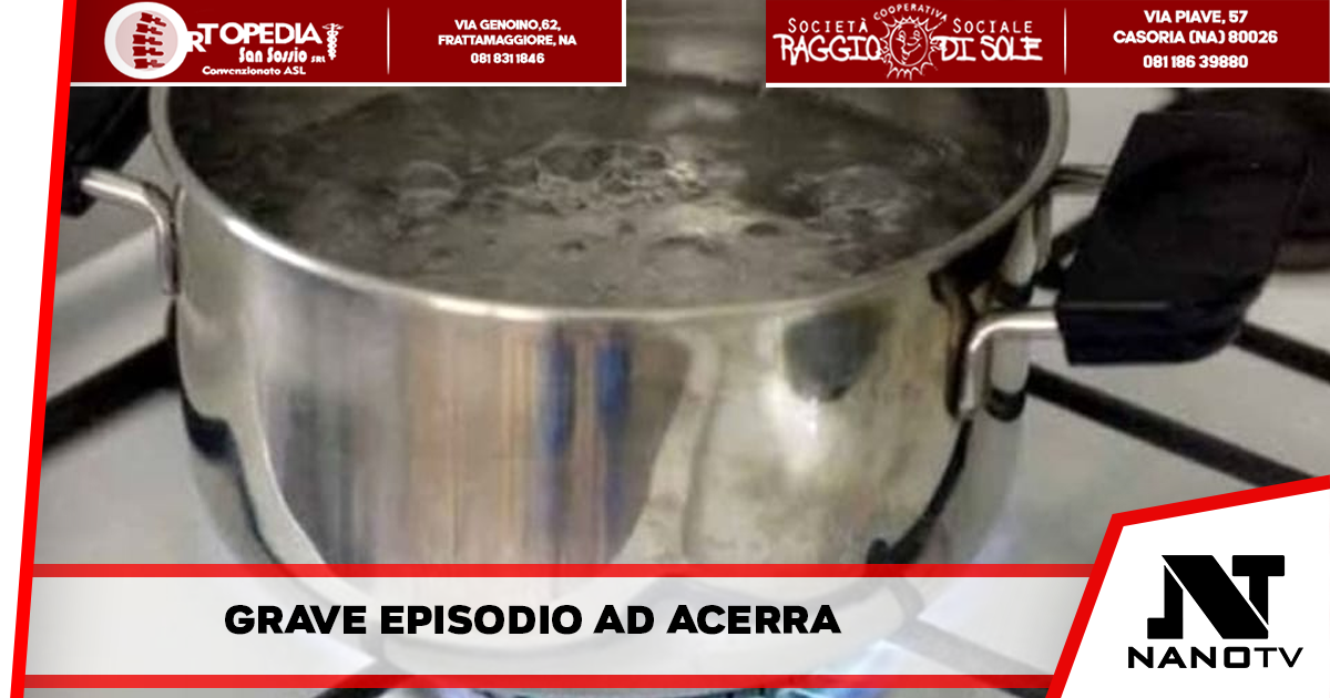 Acerra: Si rovescia addosso acqua bollente, ricoverata bimba di 3 anni