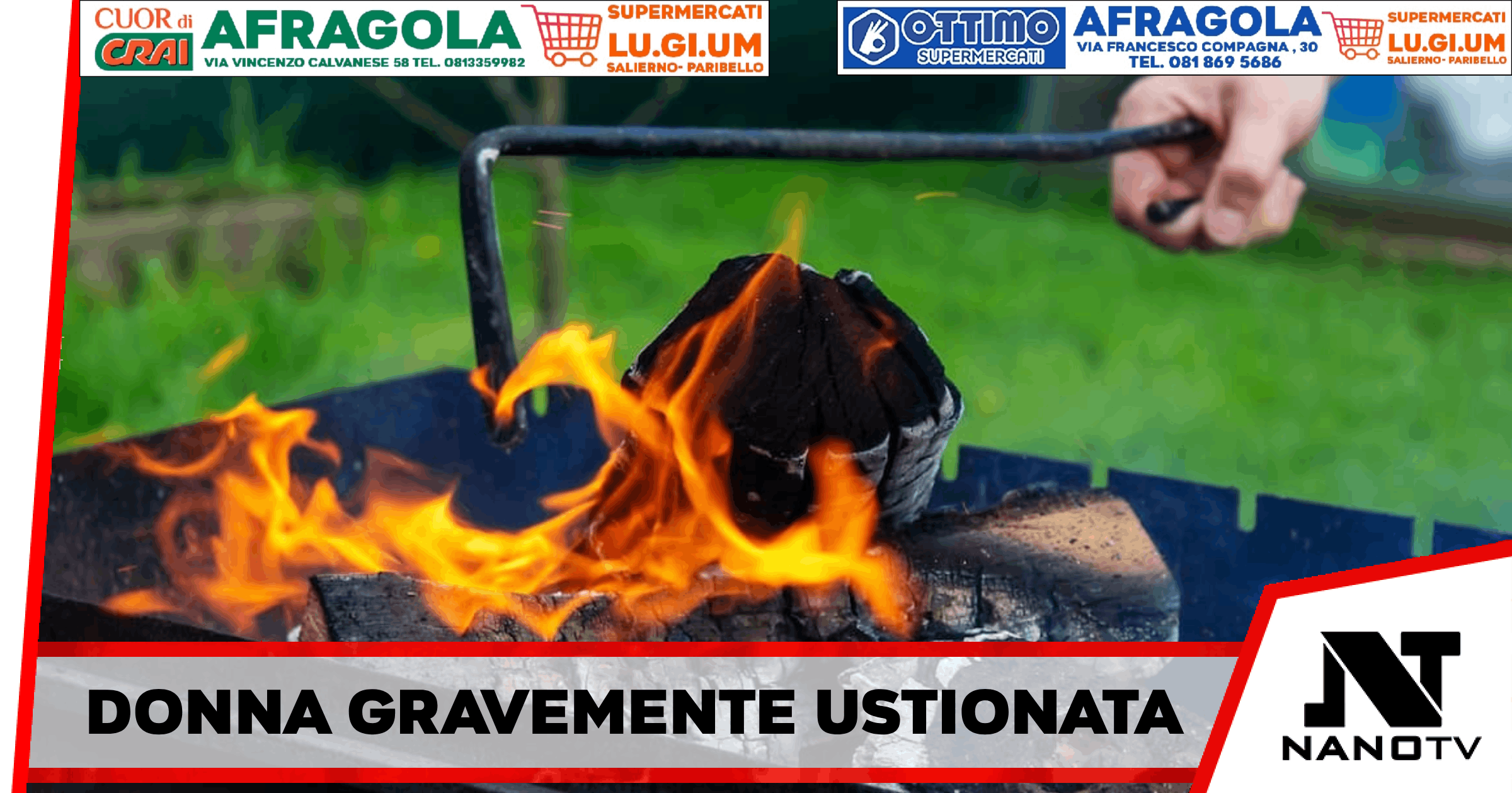 Palinuro – Donna gravemente ustionata mentre prova ad accendere il barbecue, portata al cardarelli