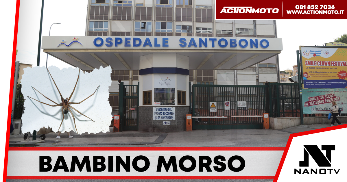 Bambino morso da ragno violino: corsa da Caivano al Santobono, ora è fuori pericolo