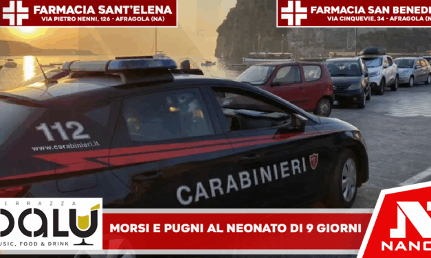 *Ischia: Morsi e pugni al volto, il neonato di 9 giorni ancora in braccio. Carabinieri arrestano 25enne*
