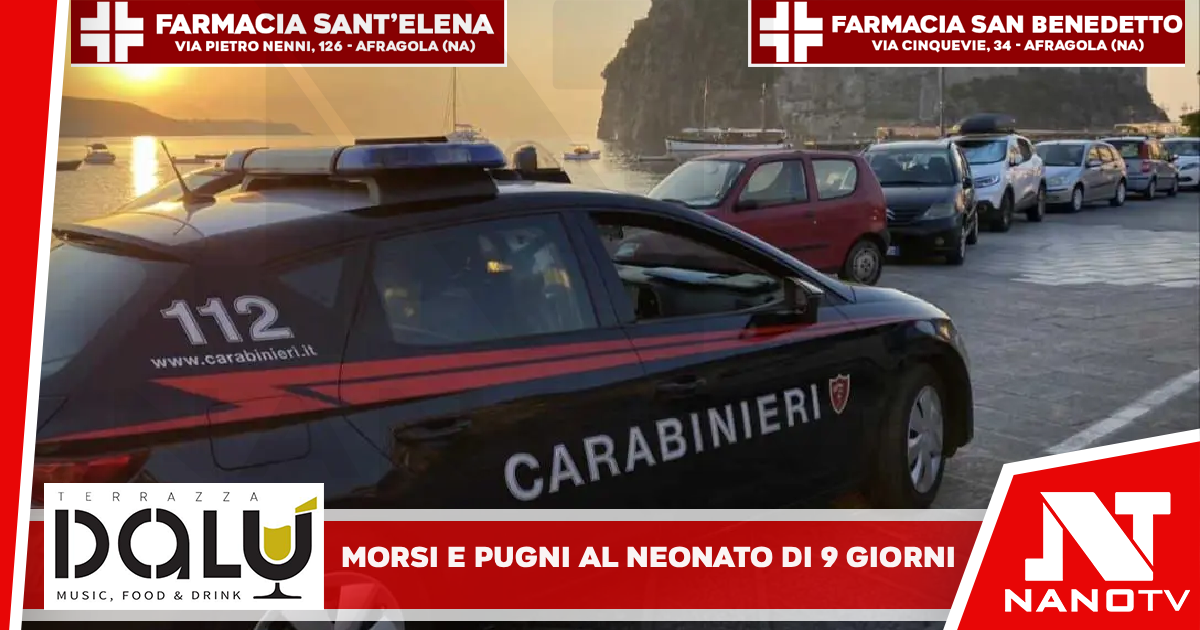 *Ischia: Morsi e pugni al volto, il neonato di 9 giorni ancora in braccio. Carabinieri arrestano 25enne*