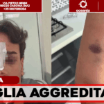Casoria, occupano il posto auto per disabili e aggrediscono madre e figlio: giovane finisce in ospedale con il setto nasale rotto