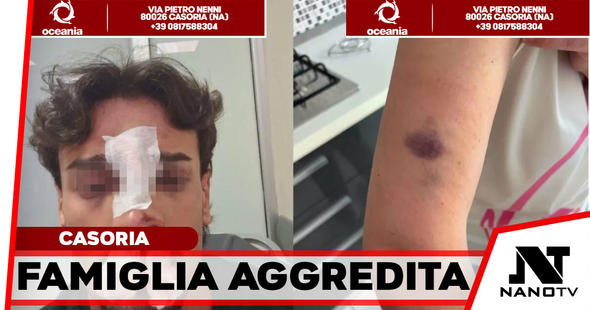 Casoria, occupano il posto auto per disabili e aggrediscono madre e figlio: giovane finisce in ospedale con il setto nasale rotto