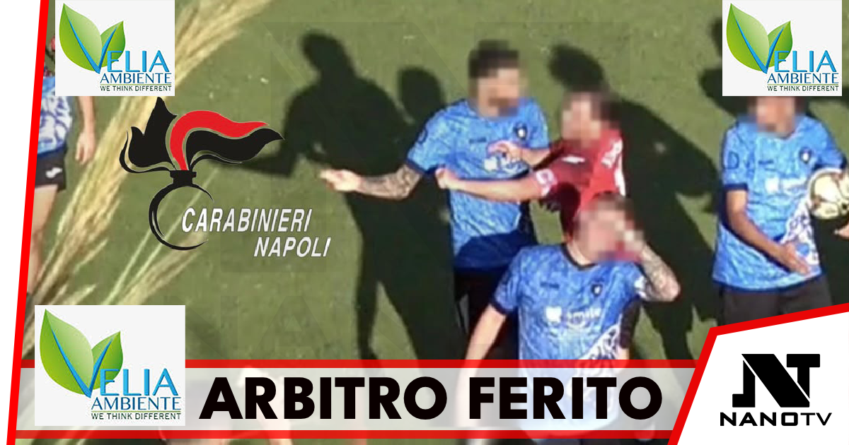*Casamicciola Terme (Isola d’Ischia): arbitro ferito. Carabinieri denunciano 12 persone*