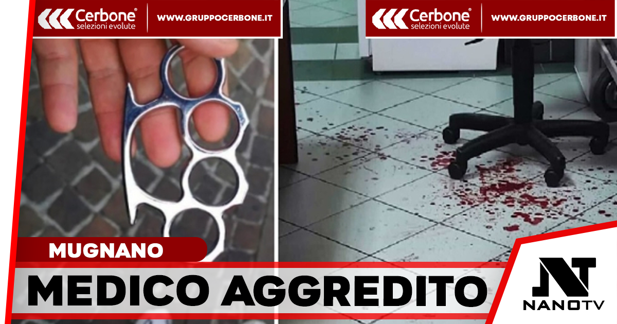 Brale aggressione a Mugnano: medico del 118 picchiato con un tirapugni da un paziente, prognosi di trenta giorni